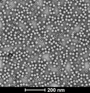 NHP-grade-TEM